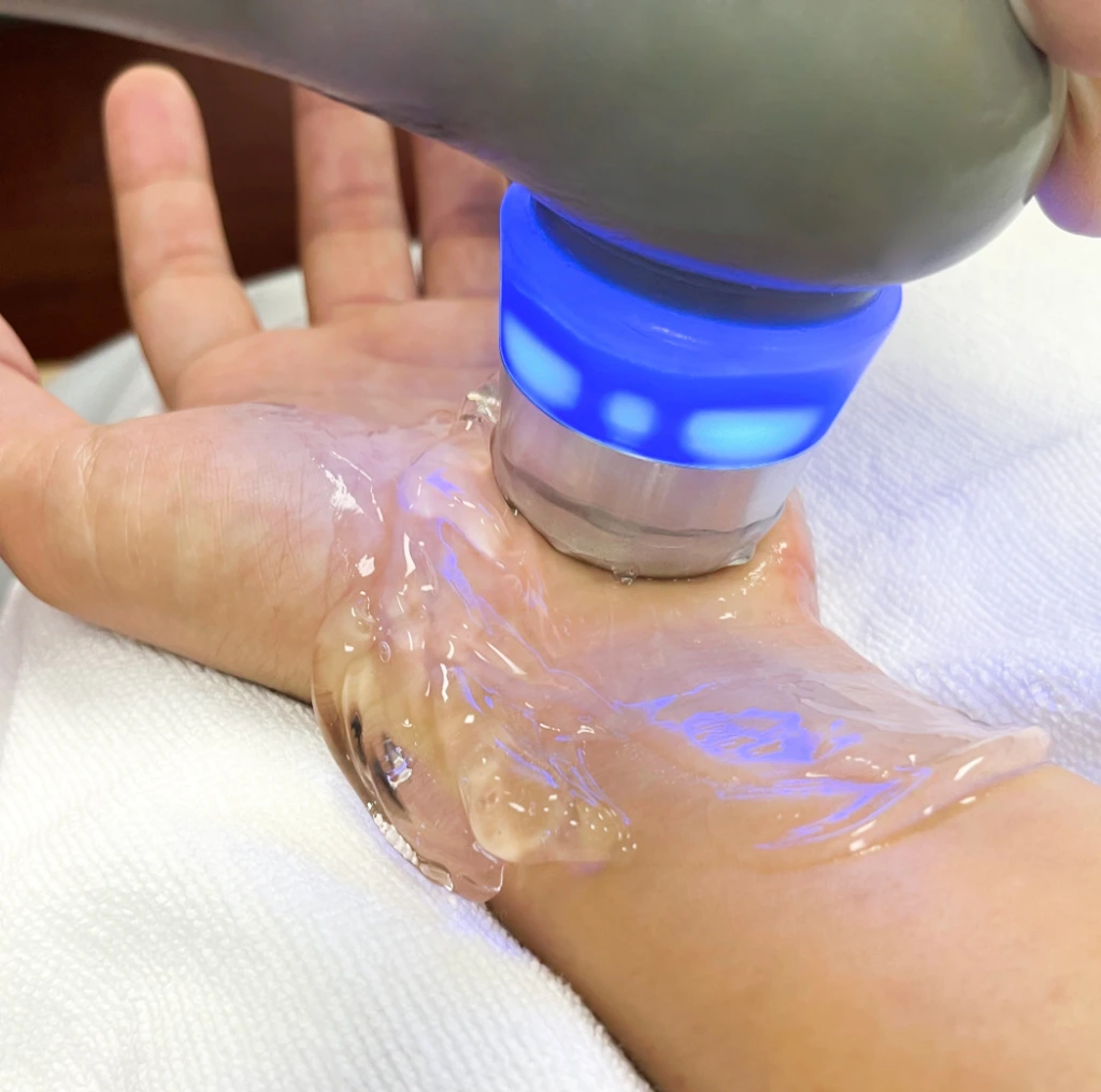 Candidates For Carpal Tunnel Syndrome Banner