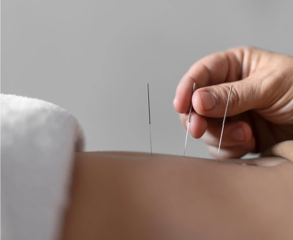 Marlboro, NJ Pain Management Treatments: Acupuncture Banner