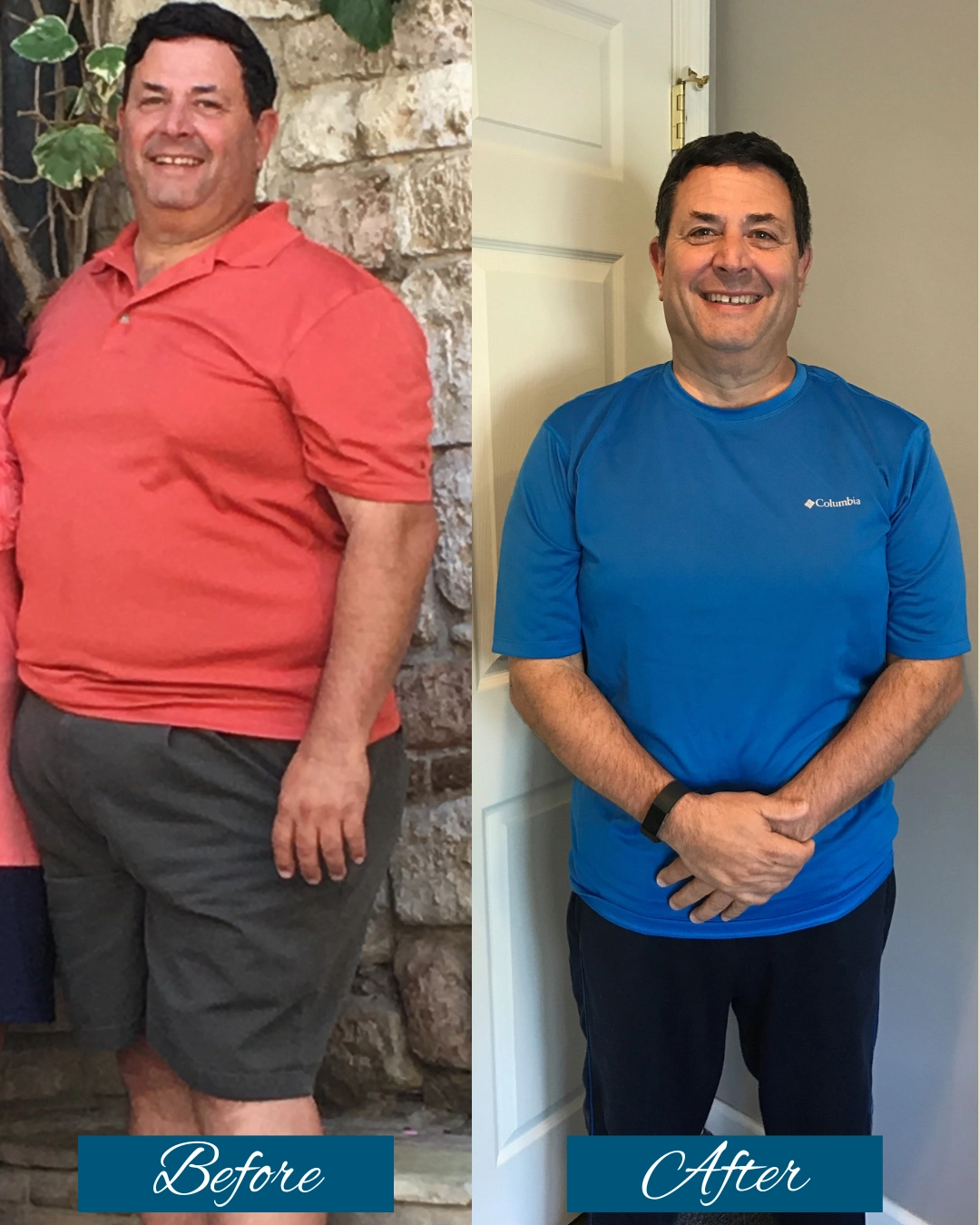 Before and after medical weight loss: man in red shirt before treatment, same man in blue shirt after treatment