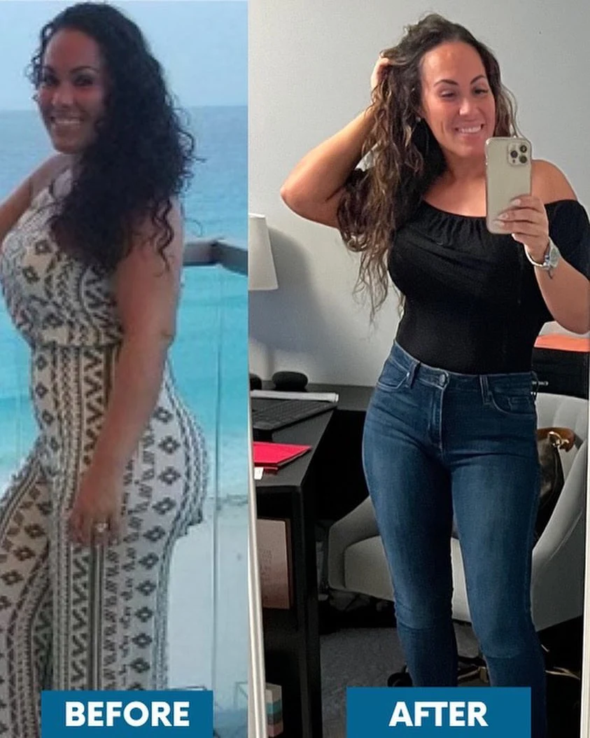 Before and after medical weight loss showing body transformation with improved overall appearance