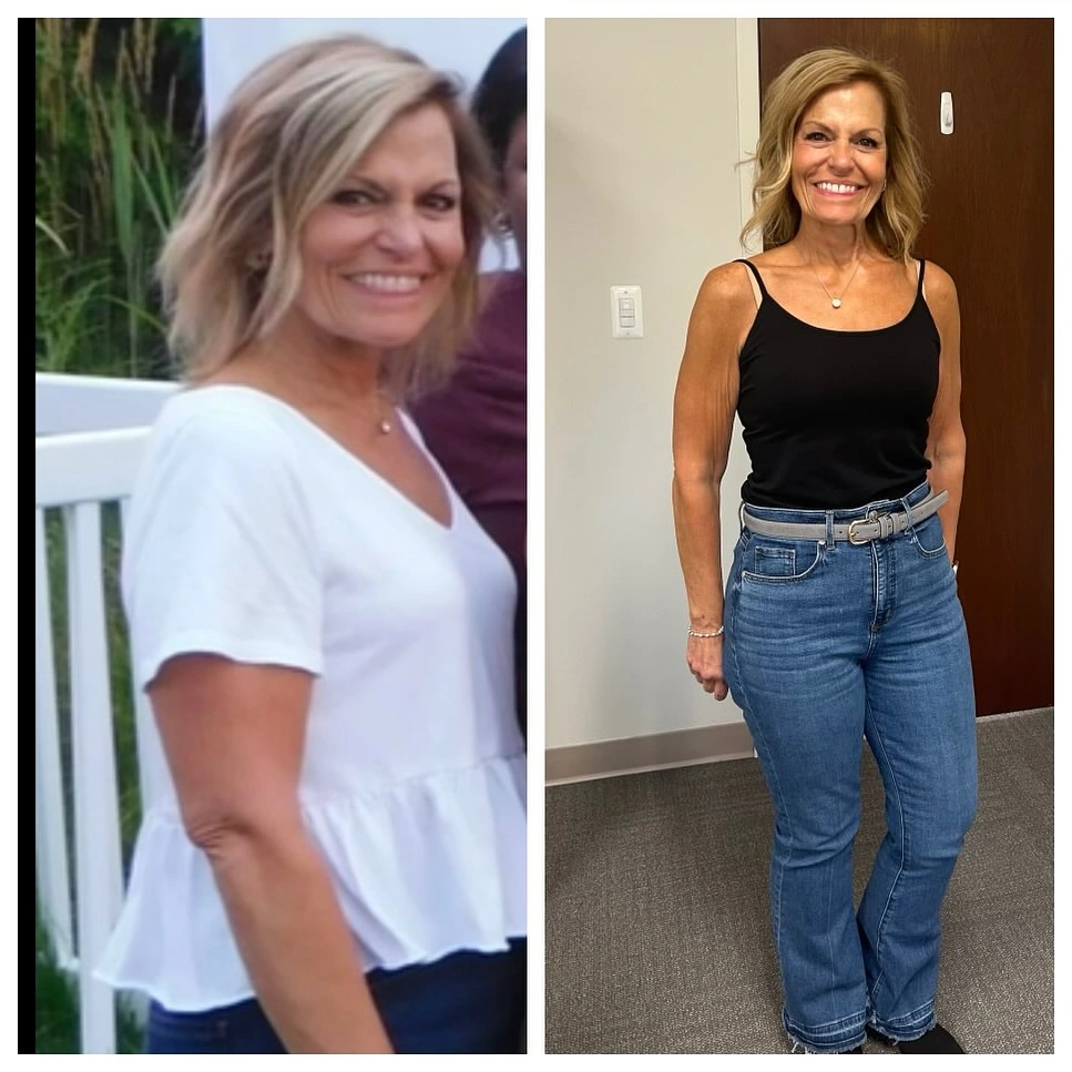 Before and after full-body photos of woman showing weight loss and body transformation results