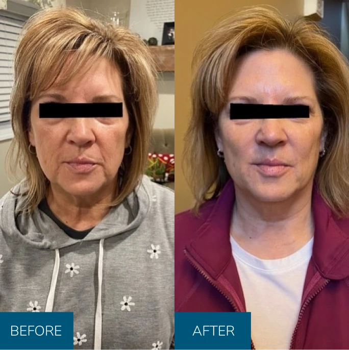 b&a img 1