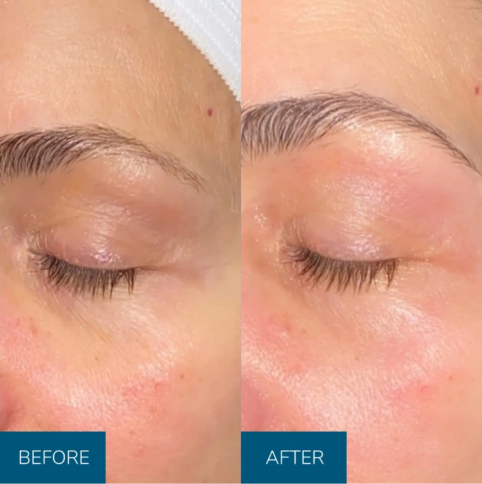 b&a img 2