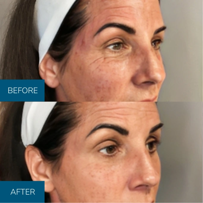 b&a img 3
