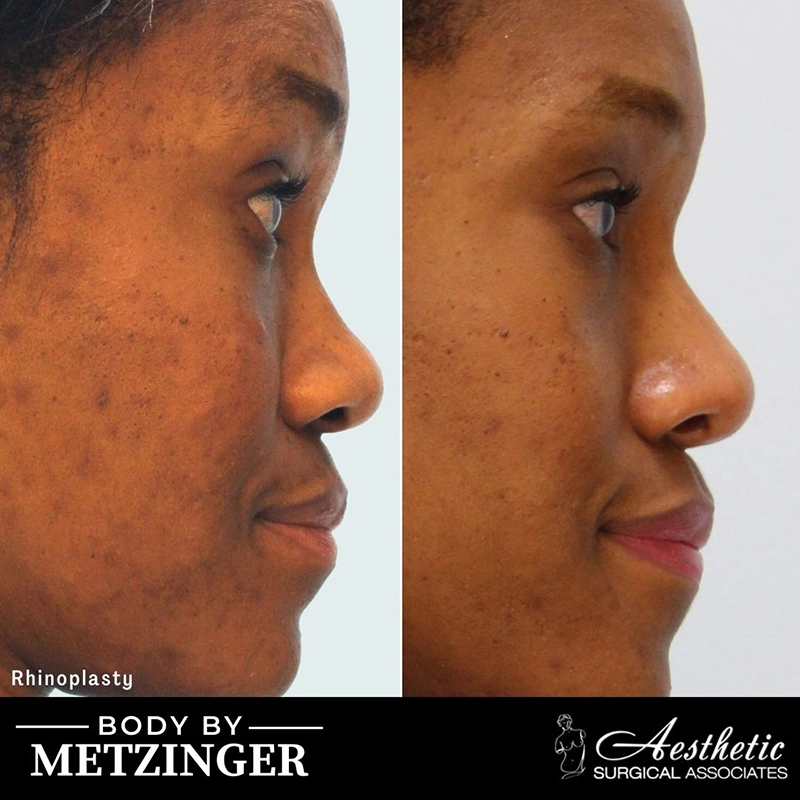 ASA B&A Library Retouched - 176