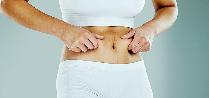 Add on Procedure: Tummy Tuck
