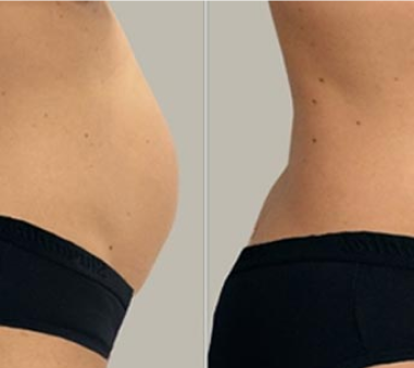 Body-Treatment