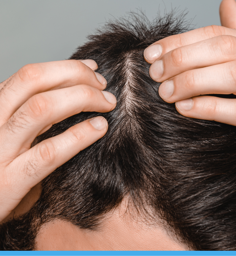 Hair Restoration Treatment in Long Island, NY Banner