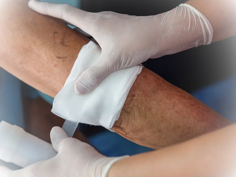 What Causes Non Healing Wounds? Common Reasons and Risk Factors
