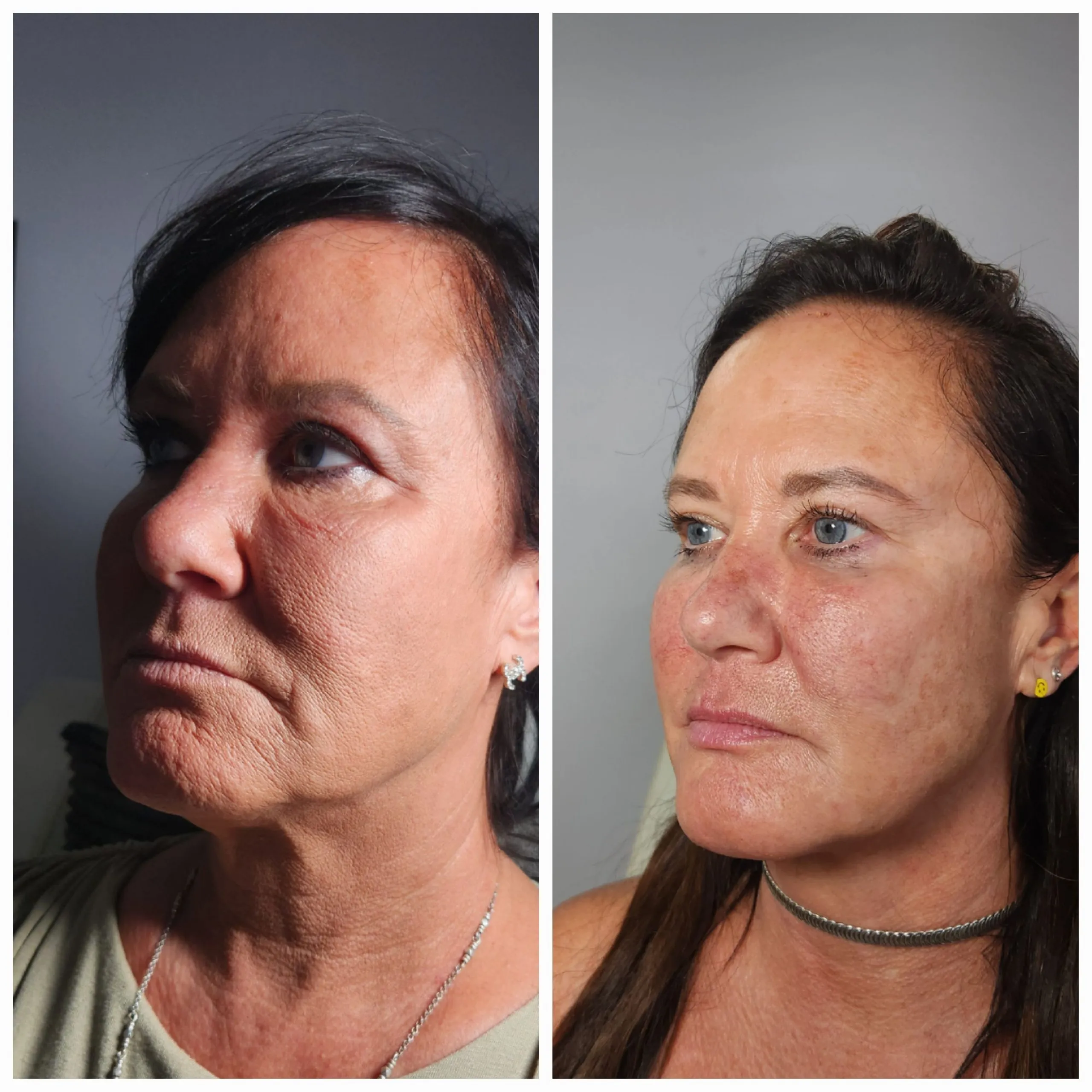 Face and neck-10