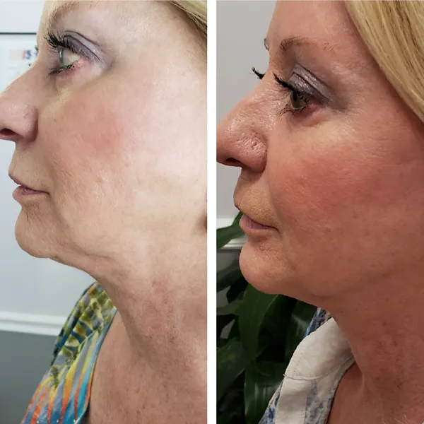 Face and neck-12.1