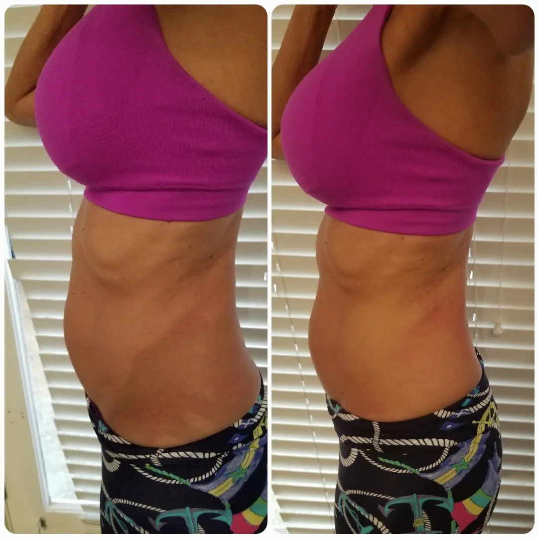 Before and after side torso view showing improved waistline definition and skin tightness