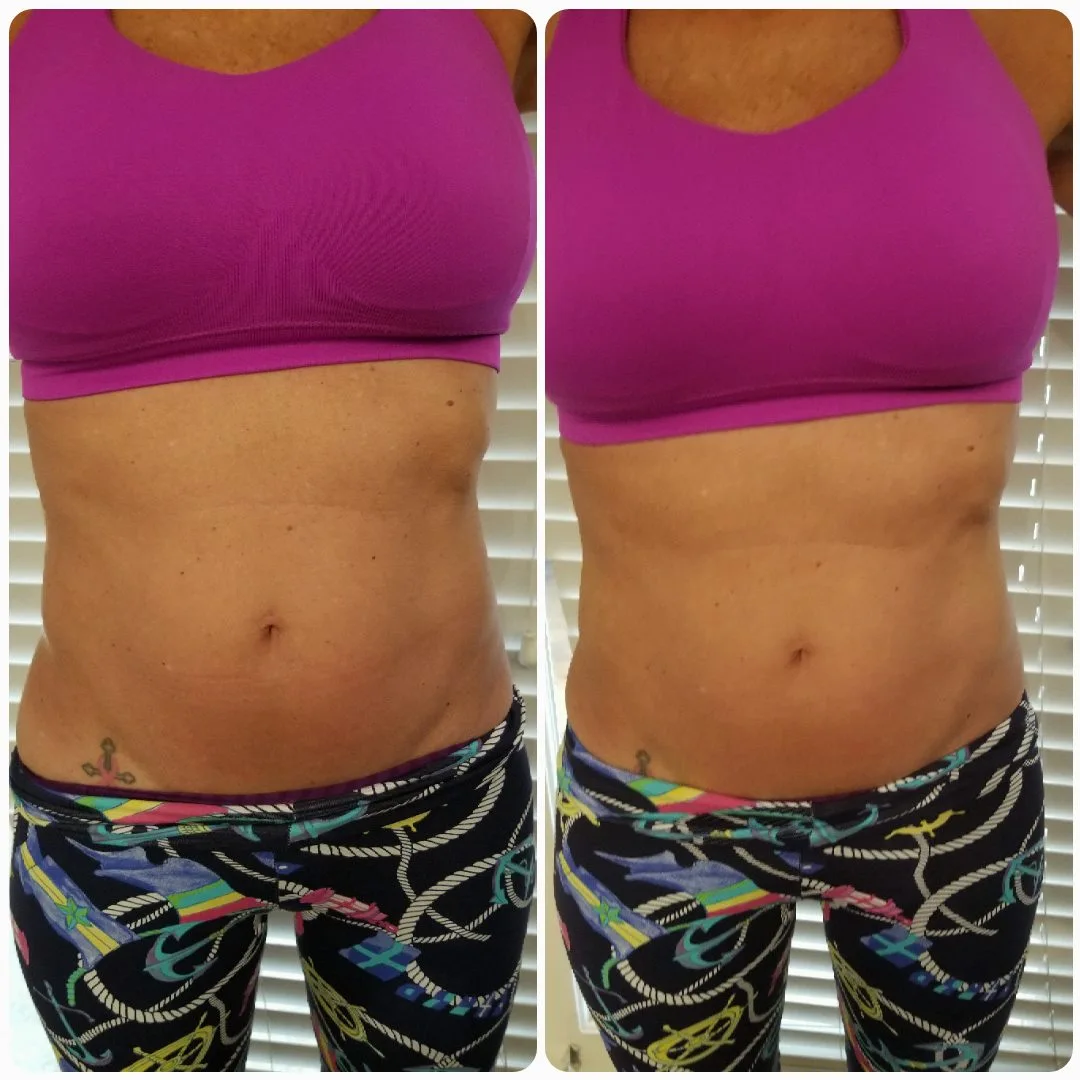 Before and after front torso view showing enhanced abdominal definition and muscle tone