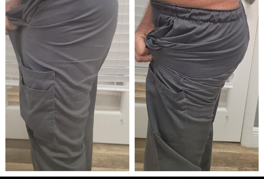 Before and after side view of hip and thigh area showing improved skin texture