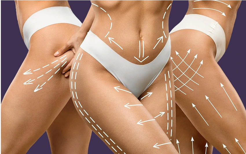 Non-Surgical Post Weight Loss Skin Tightening Boca Raton, FL Banner