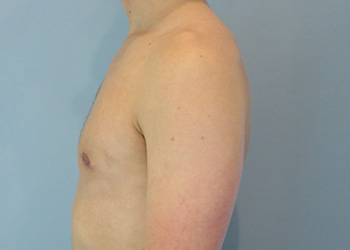 Case 1C