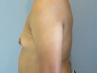Case 10 before 2