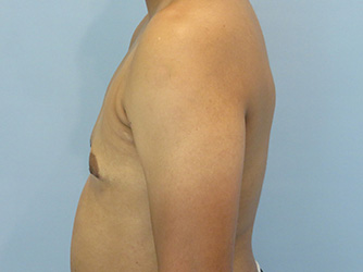 Case 10A