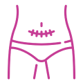 mini tummy tuck abdominal operation