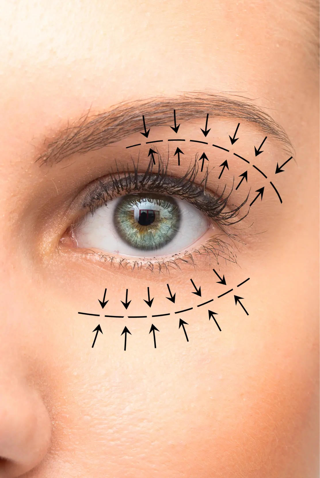 Eyelid Surgery Austin Procedures
