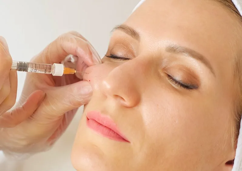 Practitioner injecting filler near patient's eye area