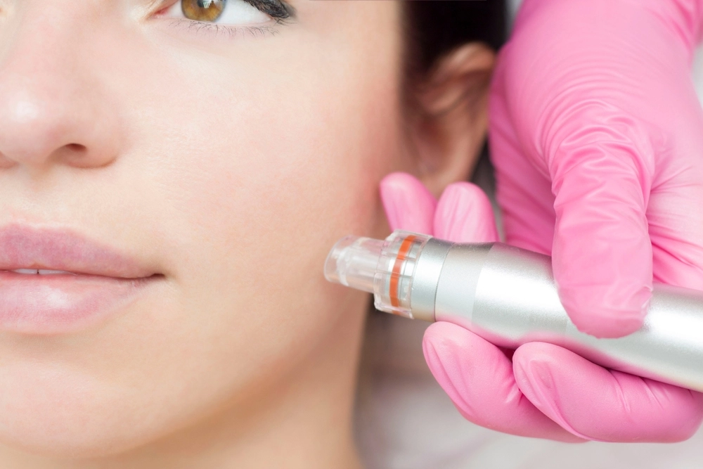 Practitioner in pink gloves using microneedling device on patient's cheek