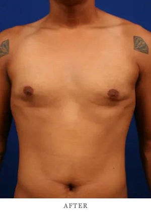 Case 1 after