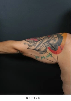 Case 1 before