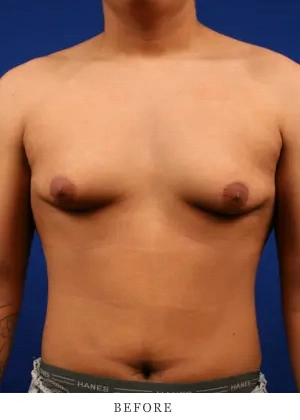 Case 1 before