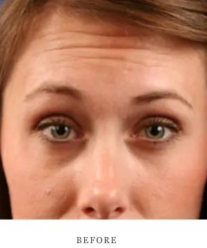 Case 1 before