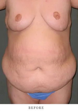 Case 12 before