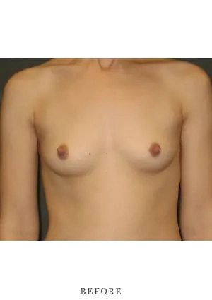 Case 15 before