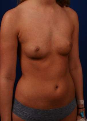 Case 23.2 before