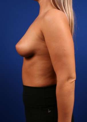 Case 25.2 before