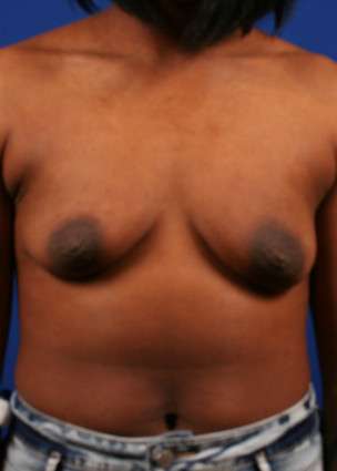 Case 29 before