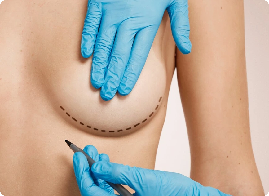 Breast Lift Banner