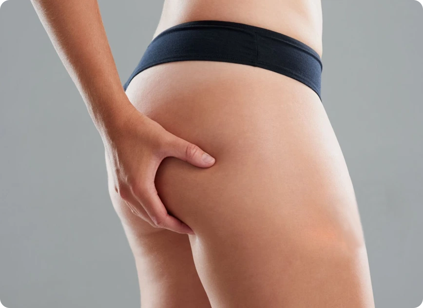 Buttock Lift Banner