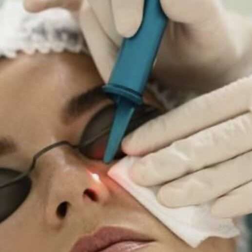Facial Vein Treatment in Springfield, MO Banner