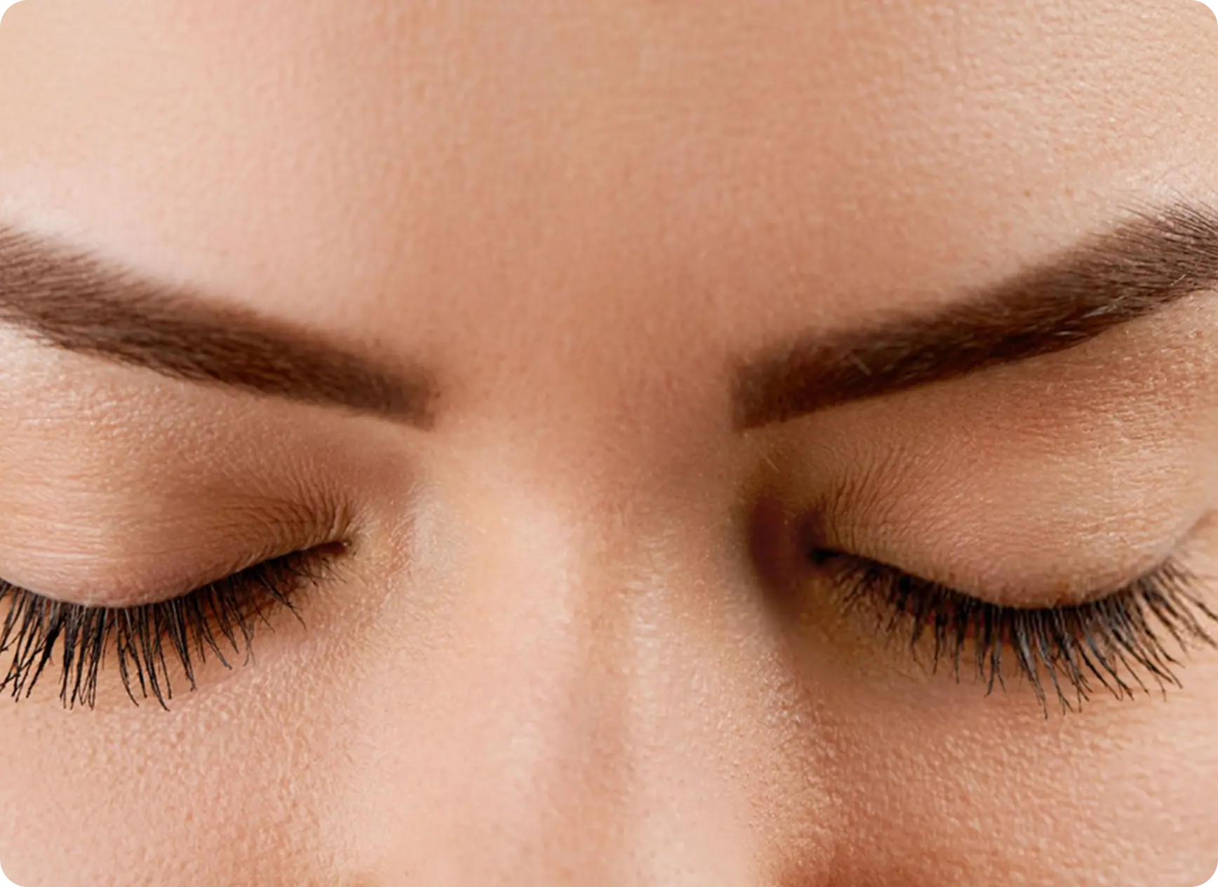 Forehead Lift Banner