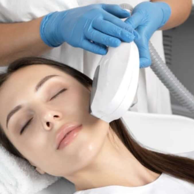 Intense Pulsed Light (IPL) in Springfield, MO Banner