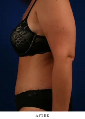 tummy 6