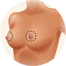 Types of Breast Lift Donut Banner