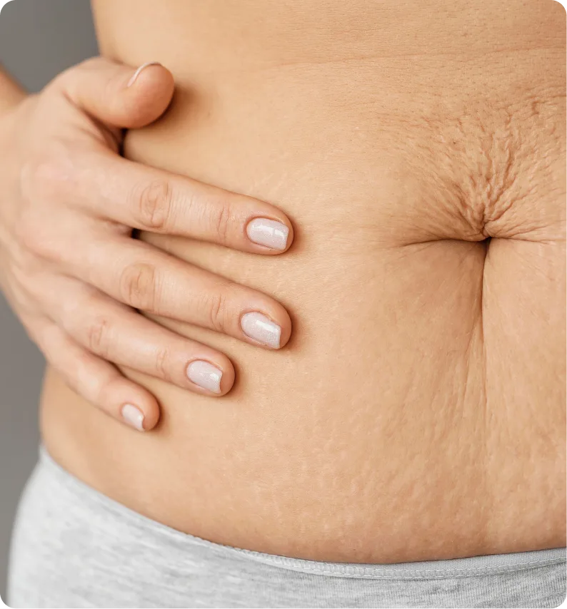 Diastasis Recti Surgery in Springfield, MO Banner