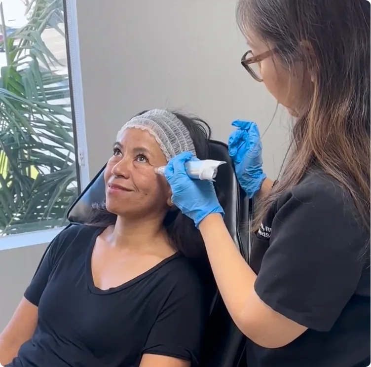 Professional Microneedling in Los Gatos, CA Banner