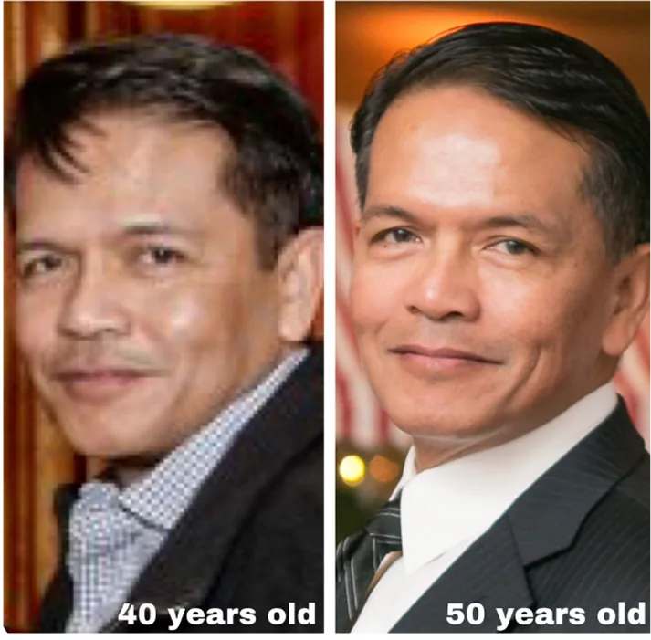 Before and after comparison of man at 40 years old and 50 years old showing facial results