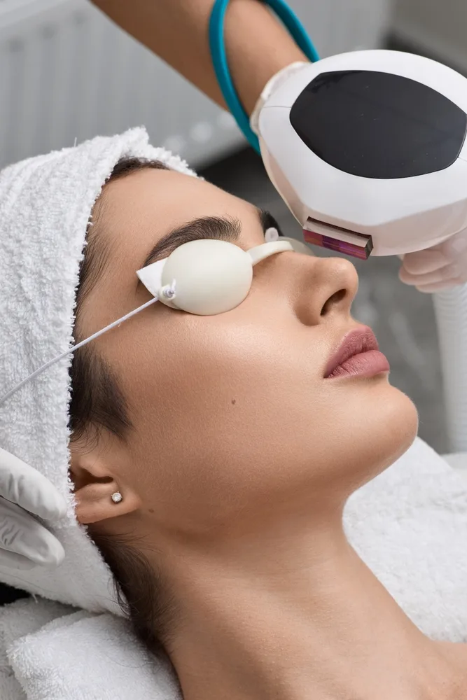 FotoFacial Treatment in Los Gatos, California Banner