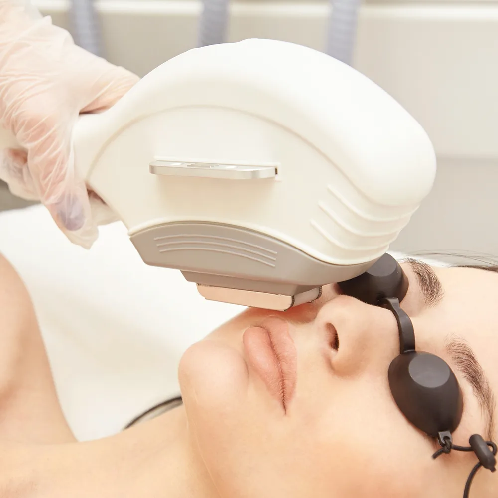 FotoFacial Treatment Los Gatos, California Banner