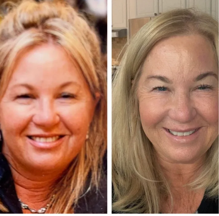 Injectable Treatments in Los Gatos, California Banner