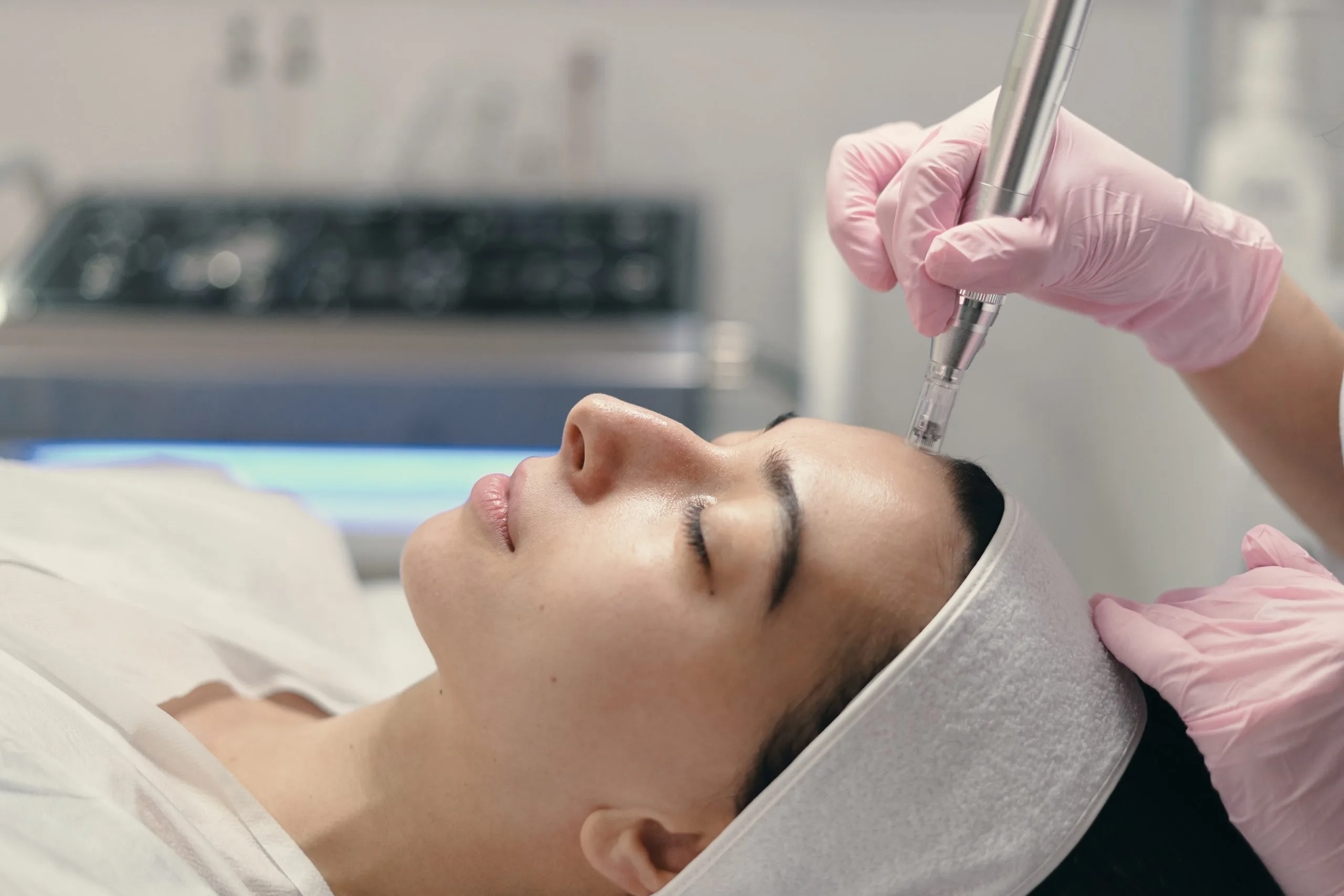 Is Microneedling Safe: What You Should Know Before Treatment Banner