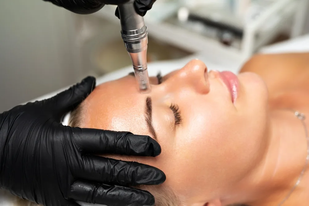 Microneedling Los Gatos, CA Banner